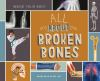 All_about_broken_bones